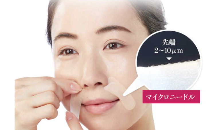 ニードルパッチの利用画像